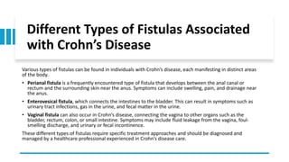 Crohn’s Disease and Fistula Care Tips.pdf
