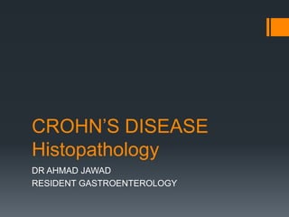 CROHN’S DISEASE
Histopathology
DR AHMAD JAWAD
RESIDENT GASTROENTEROLOGY
 