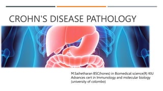 CROHN'S DISEASE PATHOLOGY
M.Saihetharan BSC(hones) in Biomedical science(R) KIU
Advances cert in Immunology and molecular biology
(university of colombo)
 