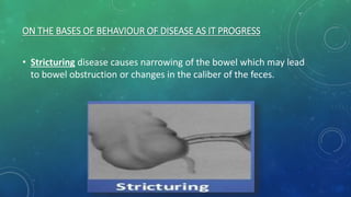 ON THE BASES OF BEHAVIOUR OF DISEASE AS IT PROGRESS
• Stricturing disease causes narrowing of the bowel which may lead
to bowel obstruction or changes in the caliber of the feces.
 
