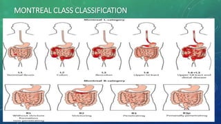 MONTREAL CLASS CLASSIFICATION
 