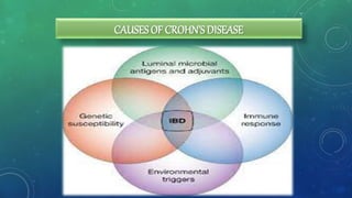 CAUSES OF CROHN’S DISEASE
 
