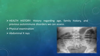  HEALTH HISTORY: History regarding age, family history, and
previous autoimmune disorders we can assess.
 Physical examination
 Abdominal X rays
 