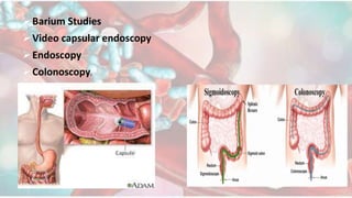 Barium Studies
Video capsular endoscopy
Endoscopy
Colonoscopy.
 