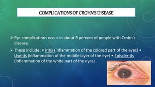 COMPLICATIONS OF CROHN’S DISEASE
 Eye complications occur in about 5 percent of people with Crohn's
disease.
 These include: • Iritis (inflammation of the colored part of the eyes) •
Uveitis (inflammation of the middle layer of the eye) • Episcleritis
(inflammation of the white part of the eyes)
 