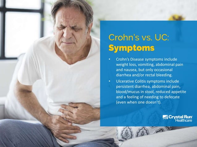 Crohn's Disease vs. Ulcerative Colitis | PDF