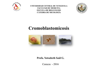UNIVERSIDAD CENTRAL DE VENEZUELA
FACULTAD DE MEDICINA
ESCUELA DE BIOANÁLISIS
CÁTEDRA DE MICOLOGÍA
Cromoblastomicosis
Profa. Yotsabeth Saúl G.
Caracas - 2016
 
