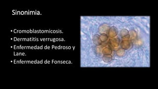 Sinonimia.
•Cromoblastomicosis.
•Dermatitis verrugosa.
•Enfermedad de Pedroso y
Lane.
•Enfermedad de Fonseca.
 
