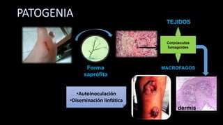 Forma
saprófita
TEJIDOS
MACROFAGOS
dermis
•Autoinoculación
•Diseminación linfática
Corpúsculos
fumagoides
 