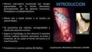 INTRODUCCION• Micosis subcutánea ocasionada por hongos
pigmentados de la familia Dematiace,
principalmente por los géneros Fonsecaea,
Phialophora y Cladophialophora.
• Afecta piel y tejido celular, y se localiza en
extremidades.
• Se caracteriza por nódulos, verrugosidades y
atrofia de evolución crónica.
• Segun su morfologıa se han descrito 5 variantes
clınicas: nodular, tumoral, verrucosa, en placa y
cicatricial, de las cuales la forma verrucosa es la
mas frecuente.
• Prevalente en varones adultos 30-50años Localizaciòn: Miembros inferiores: 54-84%
 