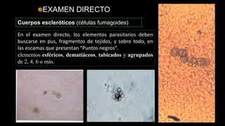 EXAMEN DIRECTO
Cuerpos escleróticos (células fumagoides)
En el examen directo, los elementos parasitarios deben
buscarse en pus, fragmentos de tejidos, y sobre todo, en
las escamas que presentan “Puntos negros”.
elementos esféricos, dematiáceos, tabicados y agrupados
de 2, 4, 6 o más.
 