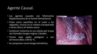 Agente Causal.
• Los agentes causales son hifomicetos
(Hyphomycetes) de la familia Dematiaceae.
• Viven como saprofitos en el suelo y los
vegetales, incluso en la madera transportada
a otros sitios y en baños sauna.
• Contienen melanina en sus células por lo que
son llamados hongos negros o feoides.
• Tienen bajo poder patógeno y son
termosensibles a 40-42 oC.
• Se comportan como hongos dimórficos.
 