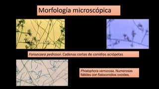 Morfología microscópica
Fonsecaea pedrosoi. Cadenas cortas de conidios acrópetas
Phialophora verrucosa. Numerosas
fiálides con fialoconidios ovoides.
 