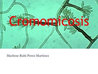 Cromomicosis
Marlene Rubi Perez Martinez
1
 