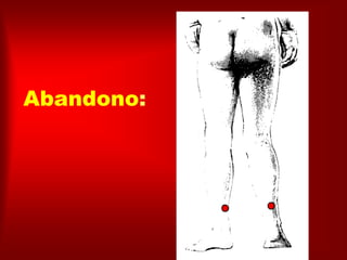 Abandono:
 