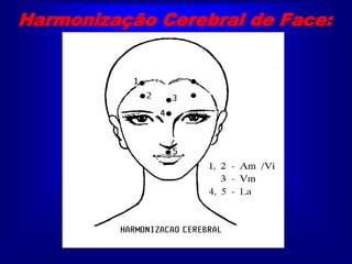 Harmonização Cerebral de Face:
 