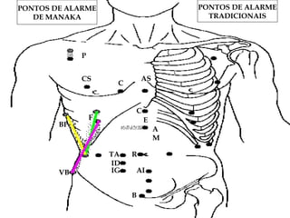 MAPA DOS PONTOS UM
P
CS AS
C
C
E
RTA
ID
IG AI
B
F
BP
VB
A
M
PONTOS DE ALARME
TRADICIONAIS
PONTOS DE ALARME
DE MANAKA
 