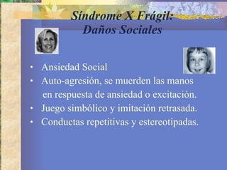 Síndrome X Frágil: Daños Sociales Ansiedad Social Auto-agresión, se muerden las manos en respuesta de ansiedad o excitación. Juego simbólico y imitación retrasada. Conductas repetitivas y estereotipadas. 