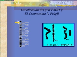 Localización del gen FMR1 y El Cromosoma X Frágil 