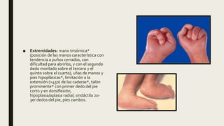 ■ Extremidades: mano trisómica*
(posición de las manos característica con
tendencia a puños cerrados, con
dificultad para abrirlos, y con el segundo
dedo montado sobre el tercero y el
quinto sobre el cuarto), uñas de manos y
pies hipoplásicas*, limitación a la
extensión (>45o) de las caderas*, talón
prominente* con primer dedo del pie
corto y en dorsiflexión,
hipoplasia/aplasia radial, sindáctila 2o-
3er dedos del pie, pies zambos.
 