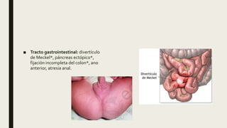 ■ Tracto gastrointestinal: divertículo
de Meckel*, páncreas ectópico*,
fijación incompleta del colon*, ano
anterior, atresia anal.
 