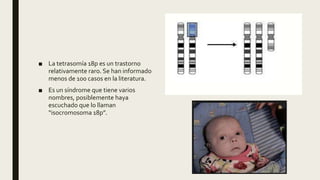 ■ La tetrasomía 18p es un trastorno
relativamente raro. Se han informado
menos de 100 casos en la literatura.
■ Es un síndrome que tiene varios
nombres, posiblemente haya
escuchado que lo llaman
“isocromosoma 18p”.
 