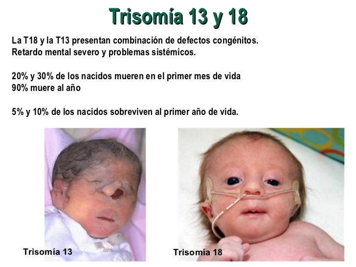 Biologia mutaciones mutaciones trisomia