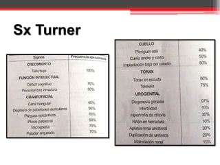 Sx Turner
 