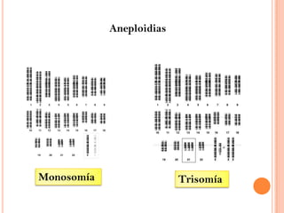 AneploidiasMonosomíaTrisomía