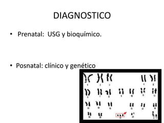 DIAGNOSTICO
• Prenatal: USG y bioquímico.

• Posnatal: clínico y genético

 