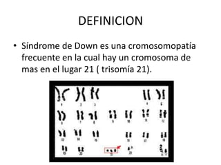 DEFINICION
• Síndrome de Down es una cromosomopatía
frecuente en la cual hay un cromosoma de
mas en el lugar 21 ( trisomía 21).

 