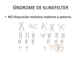 SÌNDROME DE KLINEFELTER
• NO Disyunciòn meiotica materna o paterna.

 