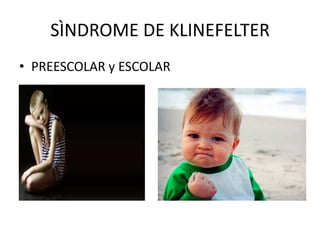 SÌNDROME DE KLINEFELTER
• PREESCOLAR y ESCOLAR

 