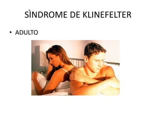 SÌNDROME DE KLINEFELTER
• ADULTO

 