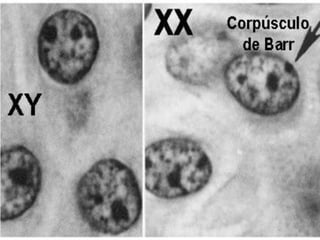 Cromosomopatìas màs frecuentes
