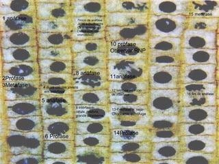 1 anáfase
10 prófase
Observar RNP
13 Telófase – veja
Citocinese centífuga
9 Intérfaase-
célula madura,
grande citoplasma
8 anáfase
7Início de anáfase
Já há espaço entre
Os cromossomos
( separação das
cromátides)
6 Profase
5 anáfase
4 duas células jovens
em intérfase
3Metáfase
2Prófase
14Prófase
11anáfase
16 fim de anáfase
15 metáfase
12 telófase ou início
de intérfase
 
