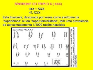 SÍNDROME DO TRIPLO X ( XXX)
44A + XXX
47, XXX
Esta trissomia, designada por vezes como síndrome da
“superfêmea” ou da “super-feminilidade”, tem uma prevalência
de aproximadamente 1/1000 recém-nascidos
 