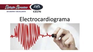 Electrocardiograma
 