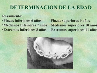 DETERMINACION DE LA EDAD Rasamiento: Pinzas inferiores 6 años  Pinzas superiores 9 años Medianos Inferiores 7 años  Medianos superiores 10 años Extremos inferiores 8 años  Extremos superiores 11 años 