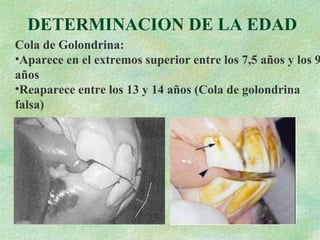DETERMINACION DE LA EDAD Cola de Golondrina: Aparece en el extremos superior entre los 7,5 años y los 9 años Reaparece entre los 13 y 14 años (Cola de golondrina falsa) 