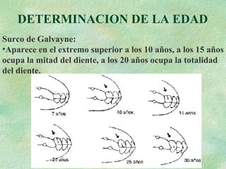 DETERMINACION DE LA EDAD Surco de Galvayne: Aparece en el extremo superior a los 10 años, a los 15 años ocupa la mitad del diente, a los 20 años ocupa la totalidad del diente. 