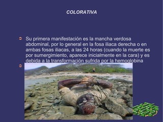 COLORATIVA




➲   Su primera manifestación es la mancha verdosa
    abdominal, por lo general en la fosa iliaca derecha o en
    ambas fosas iliacas, a las 24 horas (cuando la muerte es
    por sumergimiento, aparece inicialmente en la cara) y es
    debida a la transformación sufrida por la hemoglobina
➲
 