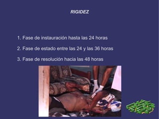 RIGIDEZ




1. Fase de instauración hasta las 24 horas

2. Fase de estado entre las 24 y las 36 horas

3. Fase de resolución hacia las 48 horas
 