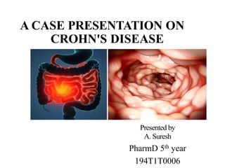 A CASE PRESENTATION ON
CROHN'S DISEASE
Presented by
A. Suresh
PharmD 5th year
194T1T0006
 