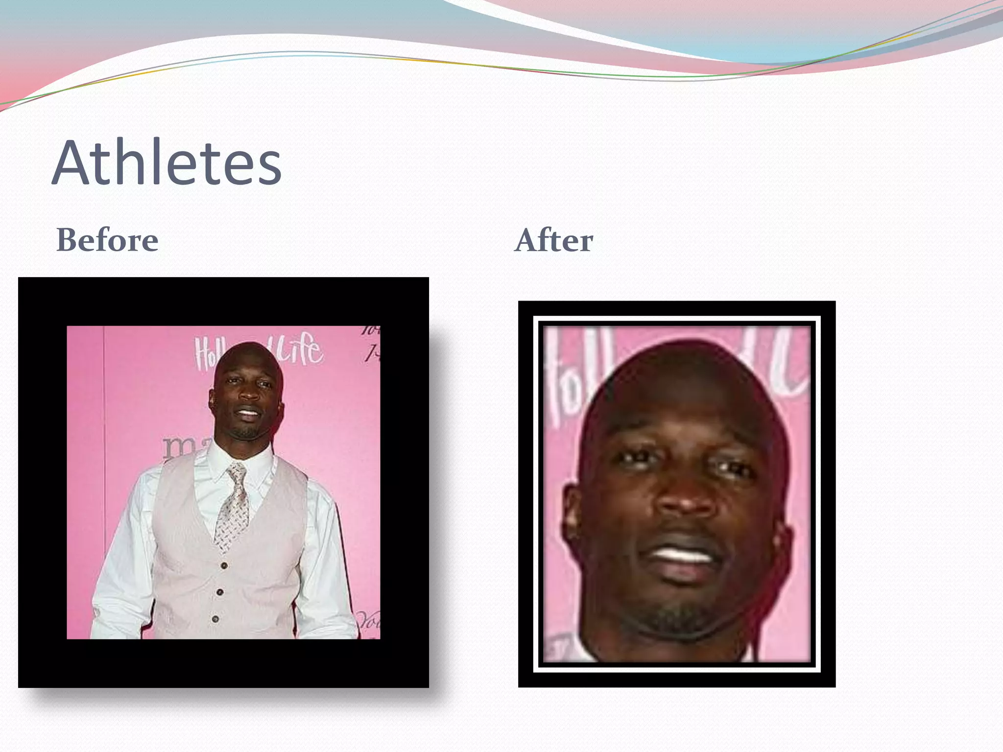 Athletes
Before After