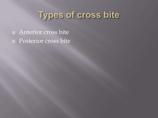 Cross bite | PPTX