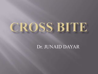 Dr. JUNAID DAYAR
 