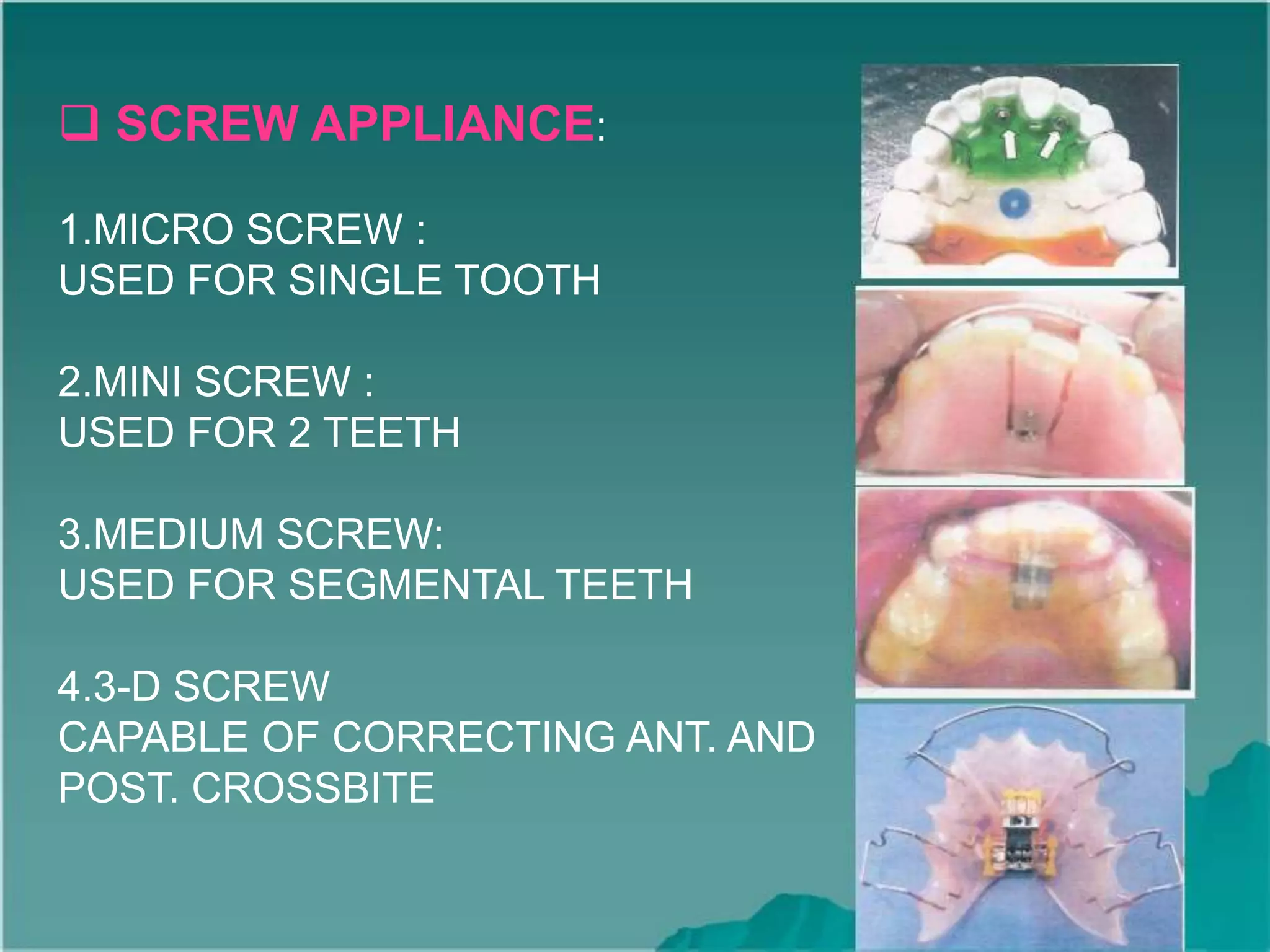  SCREW APPLIANCE:
1.MICRO SCREW :
USED FOR SINGLE TOOTH
2.MINI SCREW :
USED FOR 2 TEETH
3.MEDIUM SCREW:
USED FOR SEGMENTAL TEETH
4.3-D SCREW
CAPABLE OF CORRECTING ANT. AND
POST. CROSSBITE
 