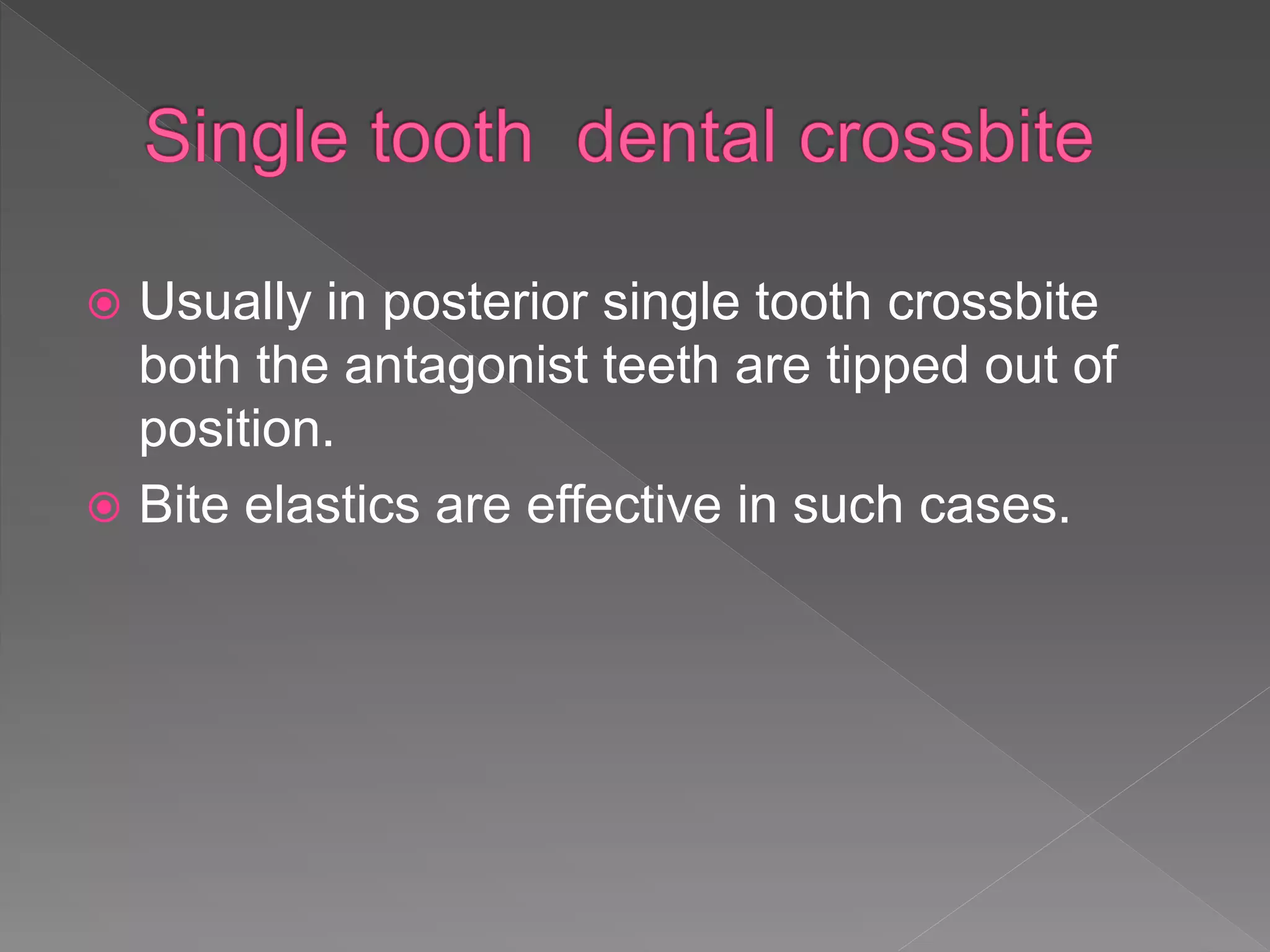  Usually in posterior single tooth crossbite
both the antagonist teeth are tipped out of
position.
 Bite elastics are effective in such cases.
 