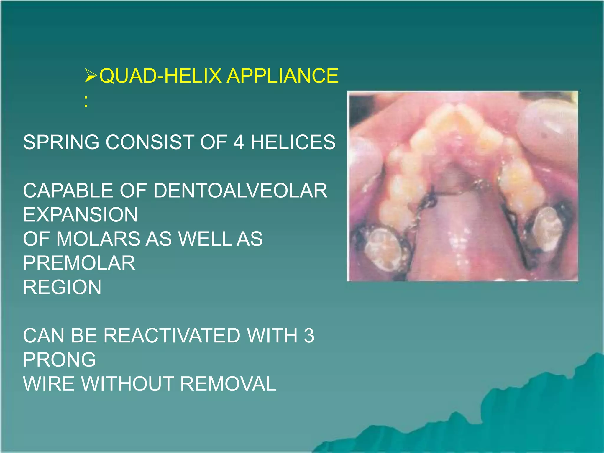 QUAD-HELIX APPLIANCE
:
SPRING CONSIST OF 4 HELICES
CAPABLE OF DENTOALVEOLAR
EXPANSION
OF MOLARS AS WELL AS
PREMOLAR
REGION
CAN BE REACTIVATED WITH 3
PRONG
WIRE WITHOUT REMOVAL
 